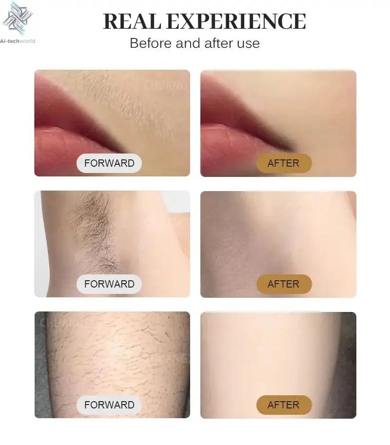 2025 Best Depilator New Ice Platinum Cooling System Skin Care 808nm Diode Laser Hair Removal Machine 3-Wavelength Ai-TechWorld 