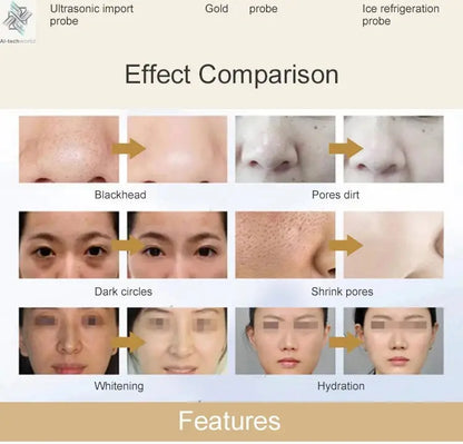 2025 Newest Profession 7 In 1 Smart Facial Cleansing Skin Analyze Deep Pore Vacuum Lift Anti-aging Beauty Machine Ice Blue Ai-TechWorld 