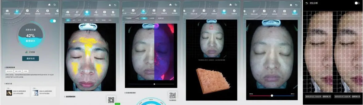 3D Skin Analyzer Machine Professional 3D Three - Dimensional Magic Mirror Skin Analysis Scanner Detector for Salon - Ai - TechWorld