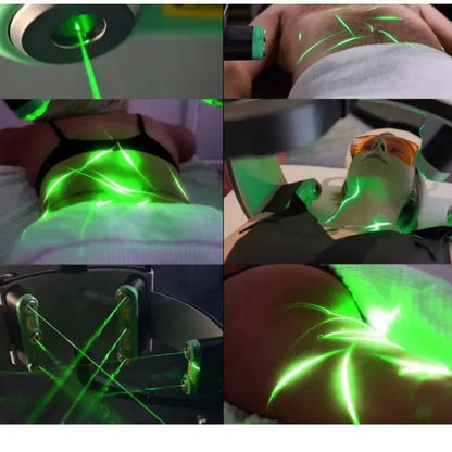 532nm Green 10D Sculpting Fat Removal Green Light Cold 532Nm Burn Fat Body Slimming - Ai - TechWorld