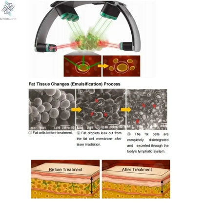 532nm Green 10D Sculpting Fat Removal Green Light Cold 532Nm Burn Fat Body Slimming - Ai - TechWorld