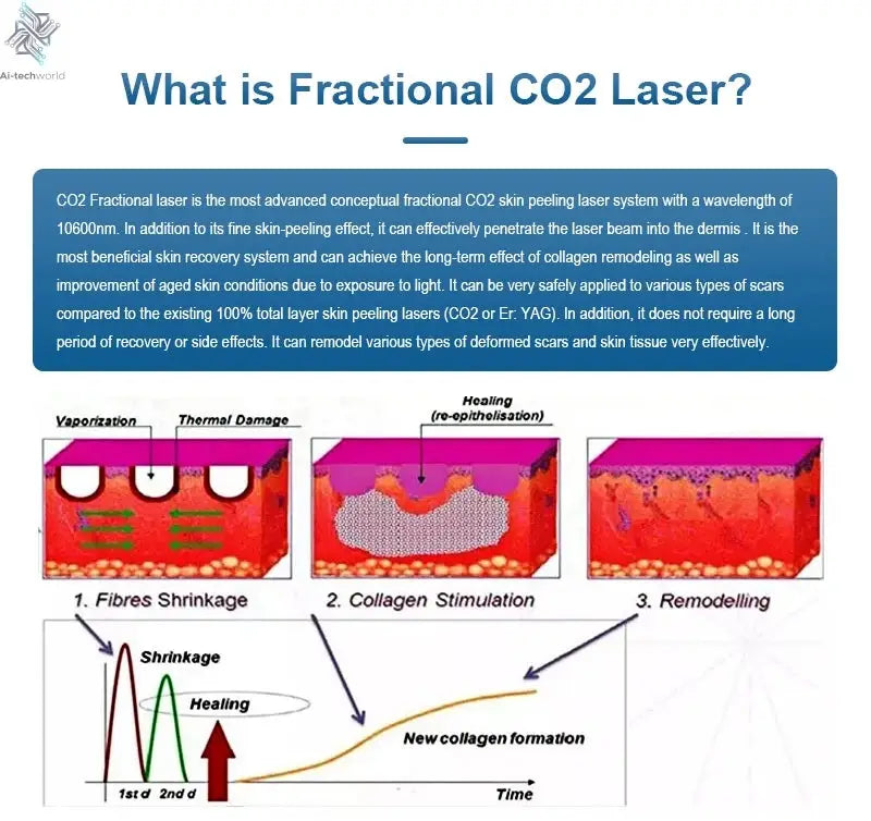 Fractional 4D CO2 Lase Scar Removal Machine 4D Fotona Co2 Fractional lase Machine Skin tightening Wrinkle Remover Ai-TechWorld 
