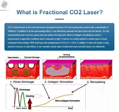 Fractional 4D CO2 Lase Scar Removal Machine 4D Fotona Co2 Fractional lase Machine Skin tightening Wrinkle Remover Ai-TechWorld 