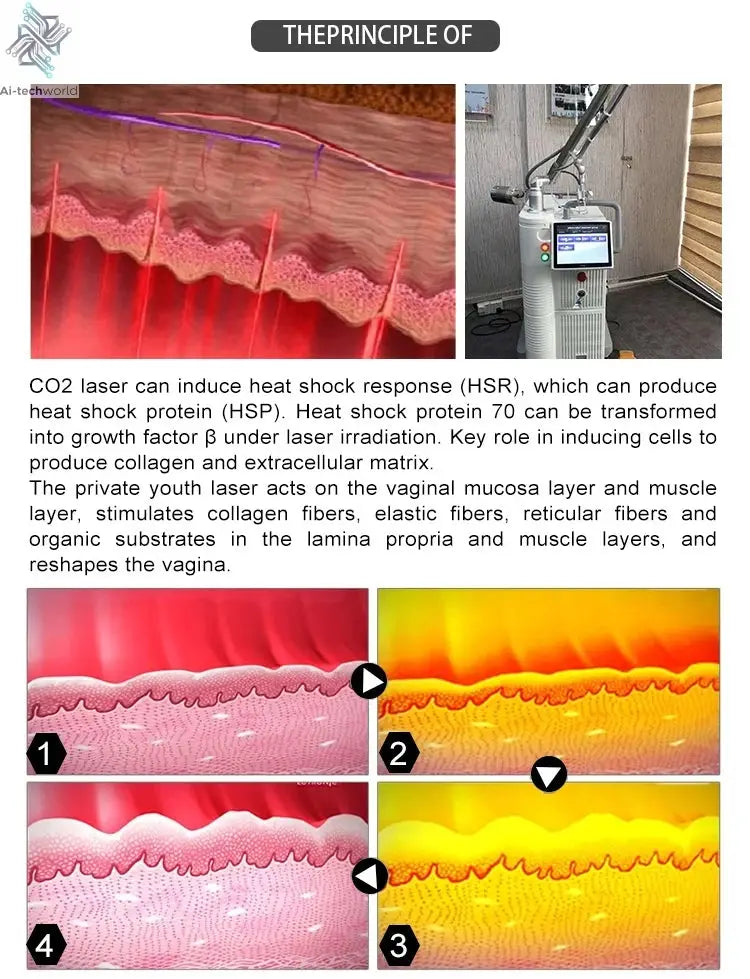 Fractional 4D CO2 Lase Scar Removal Machine 4D Fotona Co2 Fractional lase Machine Skin tightening Wrinkle Remover Ai-TechWorld 