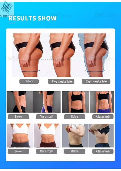 Hi - emt Neo RF Body Sculpt Machine Vacuum Inner Ball Roller Inner Ball Roller Machine 360 Degree Rolling Cellulite - Ai - TechWorld