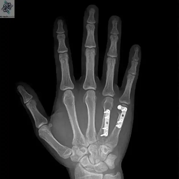 Mini Portable X Ray Machine Veterinary X Ray Machine Vet Digital X-ray Inspection Machine For Dog Cat Ai-TechWorld 