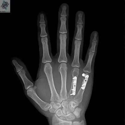 Mini Portable X Ray Machine Veterinary X Ray Machine Vet Digital X-ray Inspection Machine For Dog Cat Ai-TechWorld 