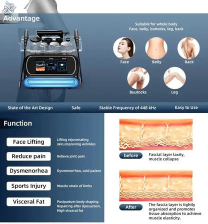 Professional 448K Physical Therapy CET RET RF Radiofrequency Indiba 448khz Physical Therapy CET RET RF CET RETMachine - Ai - TechWorld