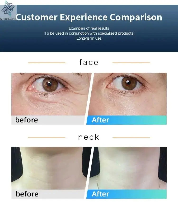 Professional 448K Physical Therapy CET RET RF Radiofrequency Indiba 448khz Physical Therapy CET RET RF CET RETMachine - Ai - TechWorld