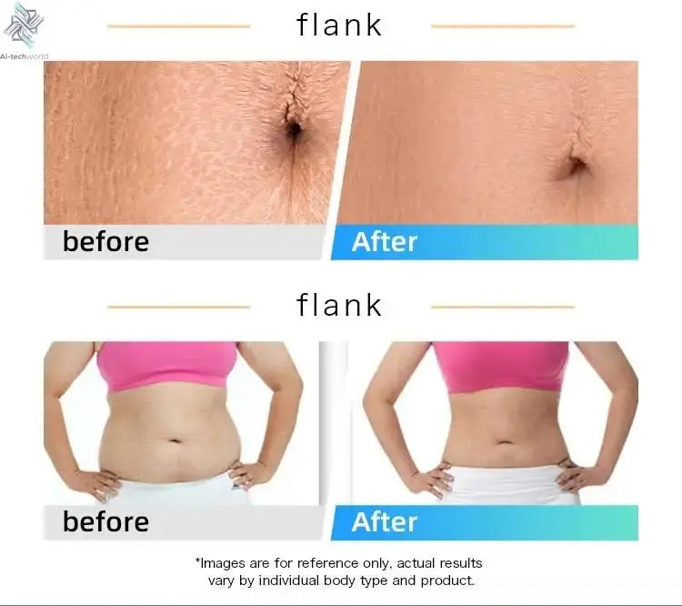 Professional 448K Physical Therapy CET RET RF Radiofrequency Indiba 448khz Physical Therapy CET RET RF CET RETMachine - Ai - TechWorld