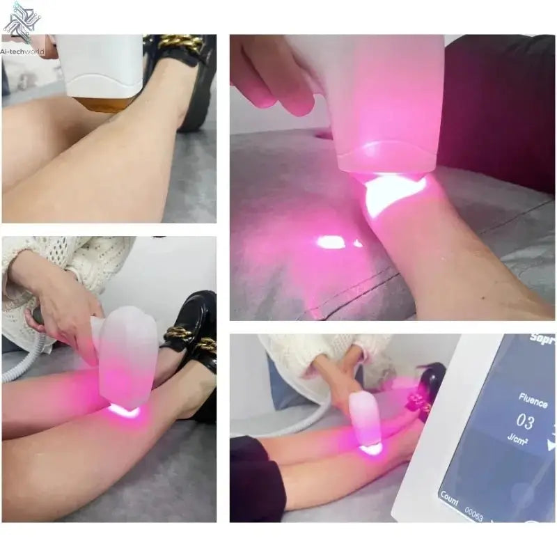 Professional Ice Titanium 808nm Diode Laser Hair Removal Machine with Triple Wavelengths for Painless Permanent Depilation Ai-TechWorld 