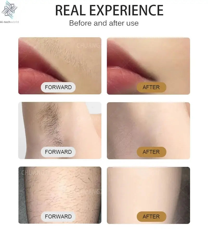 Professional Ice Titanium 808nm Diode Laser Hair Removal Machine with Triple Wavelengths for Painless Permanent Depilation Ai-TechWorld 