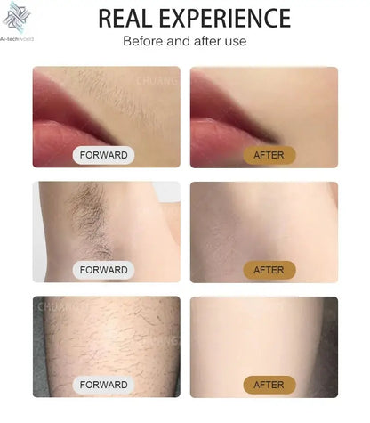 Professional Ice Titanium 808nm Diode Laser Hair Removal Machine with Triple Wavelengths for Painless Permanent Depilation Ai-TechWorld 