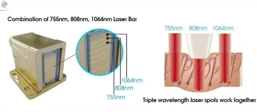Professional Ice Titanium 808nm Diode Laser Hair Removal Machine with Triple Wavelengths for Painless Permanent Depilation Ai-TechWorld 