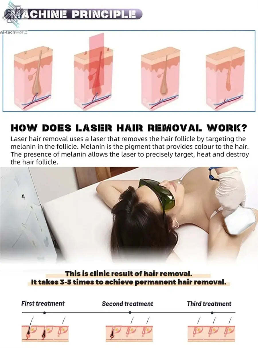 Professional Ice Titanium 808nm Diode Laser Hair Removal Machine with Triple Wavelengths for Painless Permanent Depilation Ai-TechWorld 