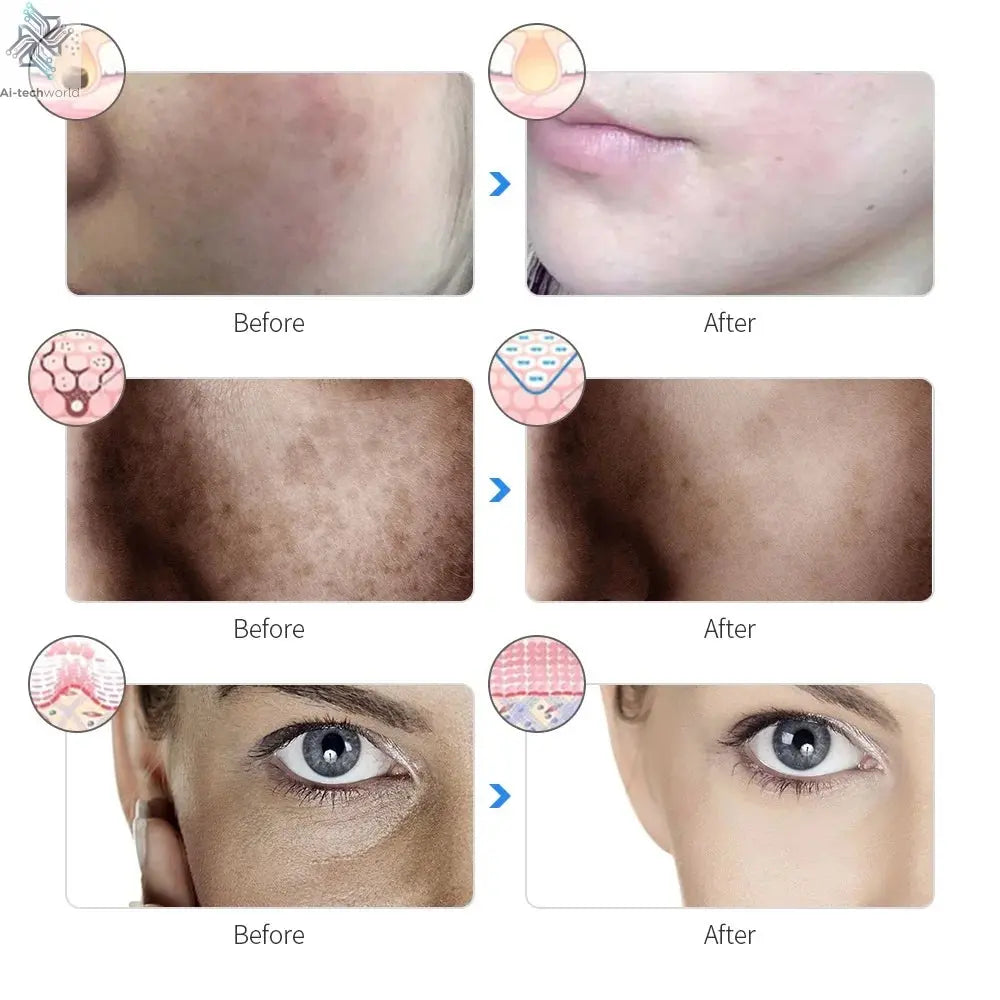 Rechargeable Facial LED Mask 7 Colors LED Photon Beauty Mask Skin Rejuvenation Home Face Lifting Whitening Skin Care Beauty Mask Ai-TechWorld 