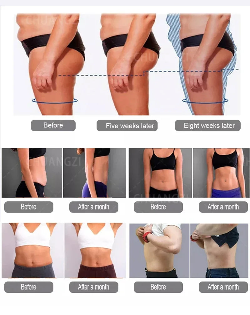 15tesla Professional 6500W 200HZ RF Body Shaping Slimming Weight lose Burns fat Muscle Enhancement massage Machine Ai-TechWorld 