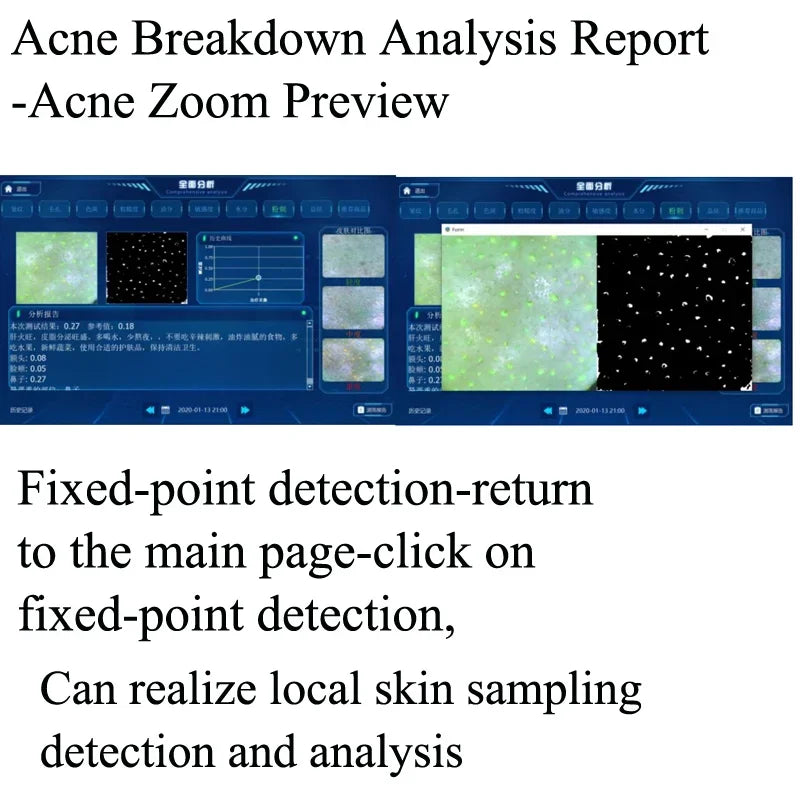 Smart Ice Blue Plus 7 in 1 Oxygen Hydro dermabrasion Bubble Machine Professional Face Hydra Machine rf Lifting ultrason machine Ai-TechWorld 