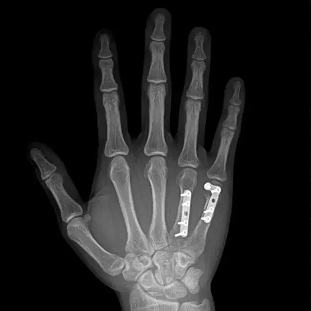 Mini Portable X Ray Machine Veterinary X Ray Machine Vet Digital X-ray Inspection Machine For Dog Cat Ai-TechWorld 