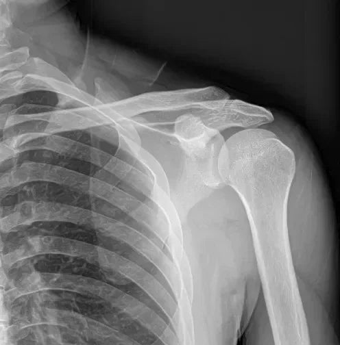 Mini Portable X Ray Machine Veterinary X Ray Machine Vet Digital X-ray Inspection Machine For Dog Cat Ai-TechWorld 