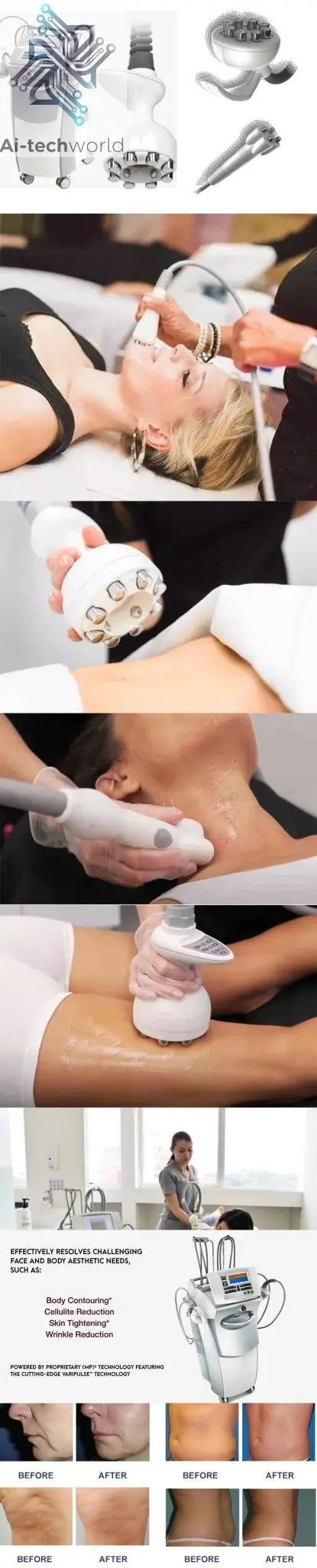 Venus Legacy Body Treatment 3 in 1 Venus Legacy Cabezal De Radiofrecuencia Corporal - Ai - TechWorld