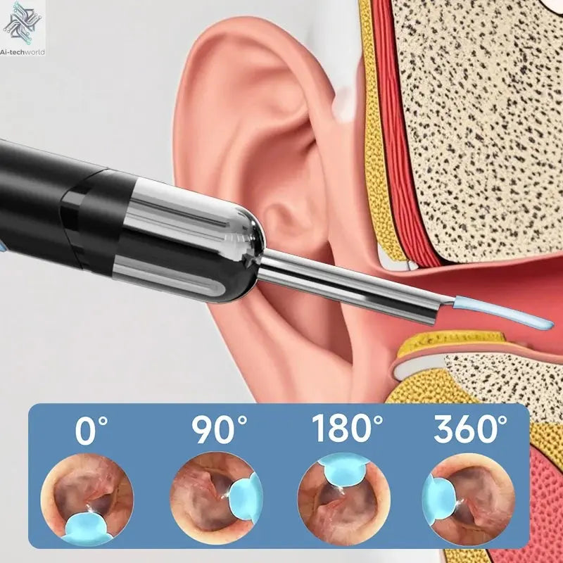 WiFi Endoscope 4.2mm 1080P Ear Picker Camera with Ear Spoon Base for iOS/Android Ear Cleaning Otoscope with Ear Wax Removal Tool Ai-TechWorld 