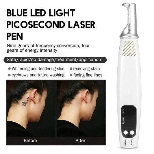Handheld Picosecond Laser Pen Tattoo Scar Freckle Removal Machine Skin Beauty Device - Ai - TechWorld