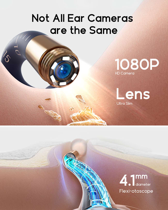 2025 New Bebird Earsight Plus I35R Ear Wax Removal Tool Camera Cleaner Kit- HD Wireless Flexible Otoscope, Pain-Free Ear Tweezer Ai-TechWorld 