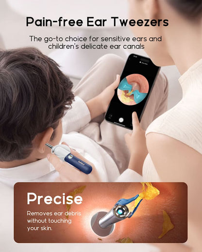 2025 New Bebird Earsight Plus I35R Ear Wax Removal Tool Camera Cleaner Kit- HD Wireless Flexible Otoscope, Pain-Free Ear Tweezer Ai-TechWorld 